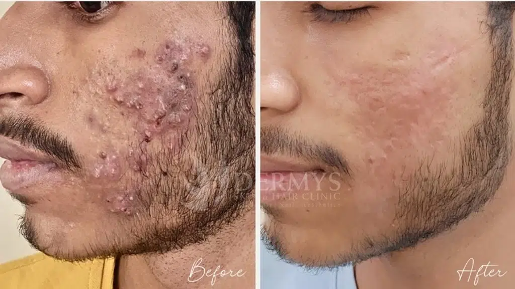 Dermys Skin and Hair Clinic