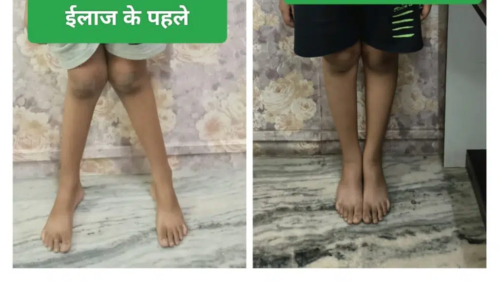 ojas clinic eye & fracture, Dr Vivek Shrivastava