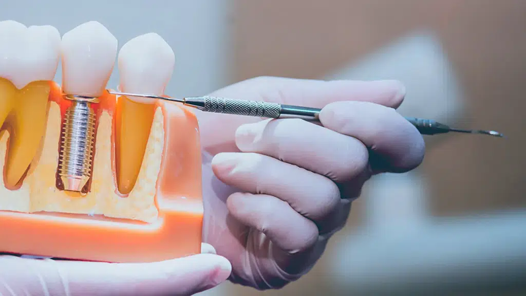 Smizel Smile Design Studio and Implant Center