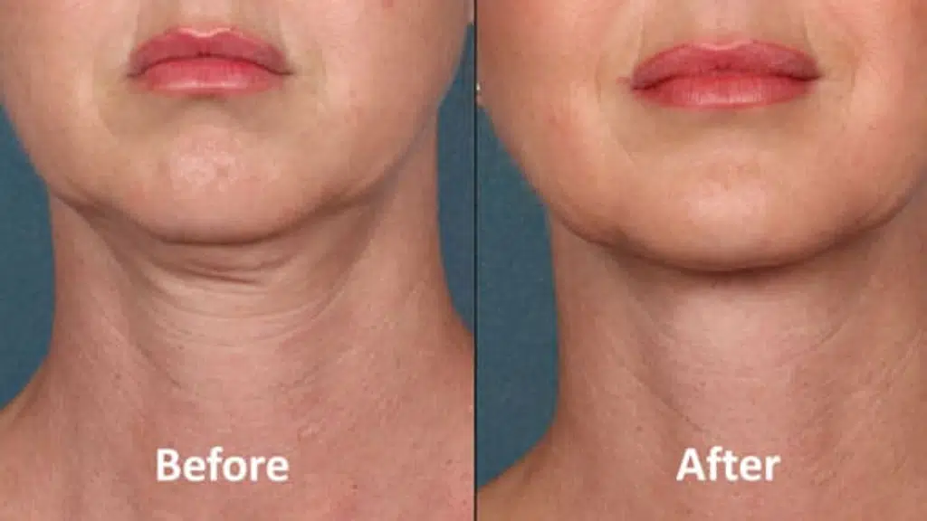 Dr. Parul's Skiin Ace Clinic