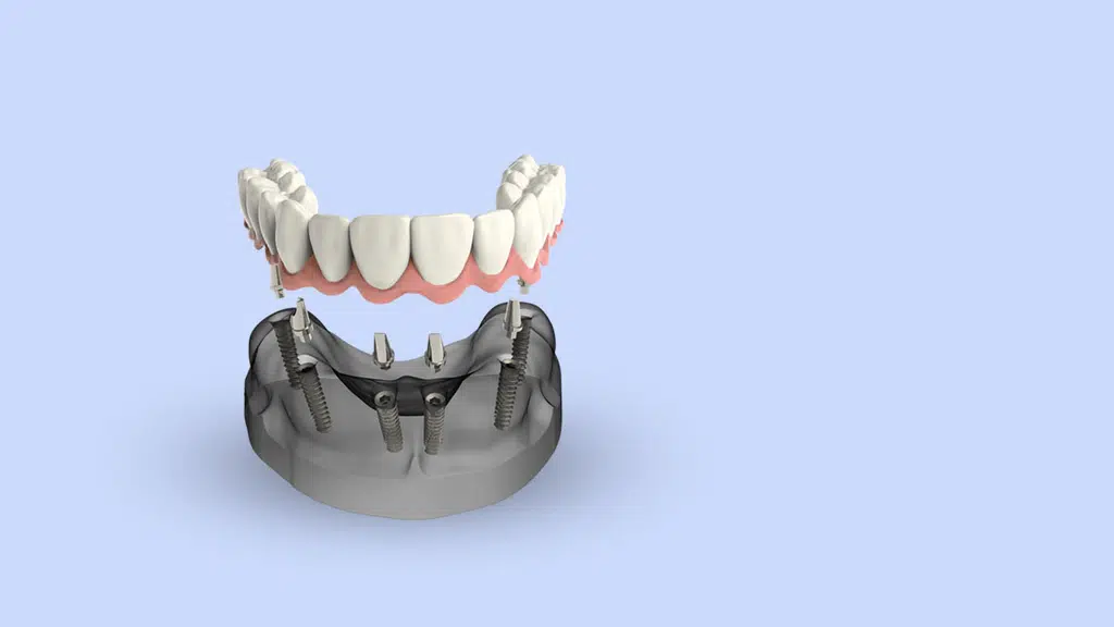 Chinthamani Laser Dental Clinic