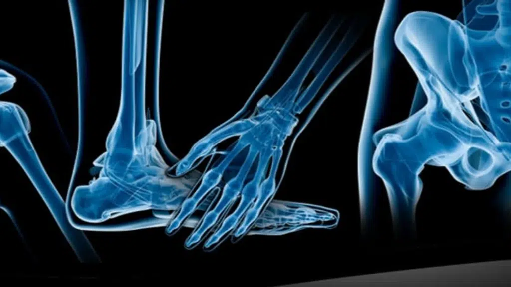 Osteon Orthopedic Hospital