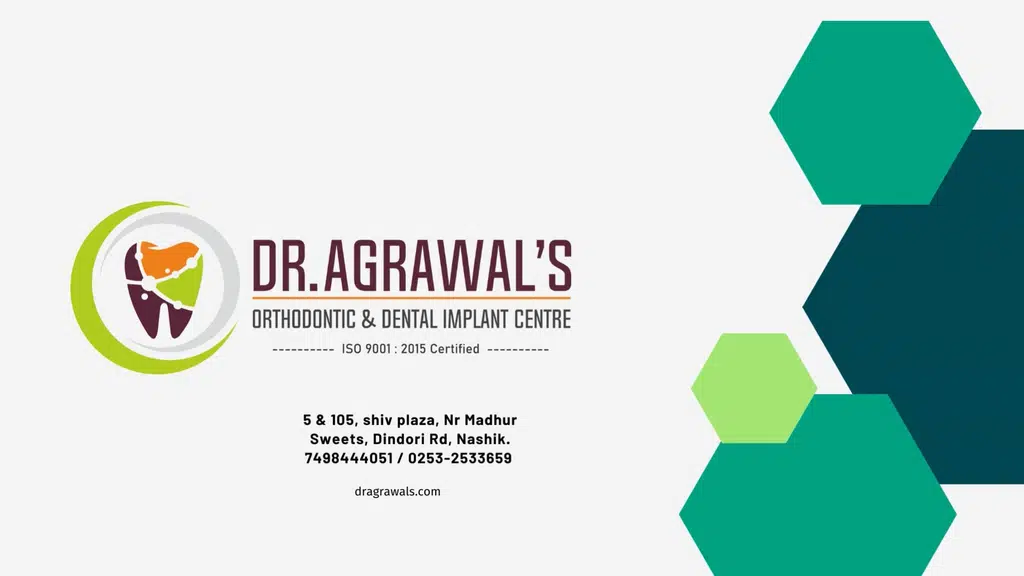 Dr. Agrawal's Orthodontic & Dental Implant Centre