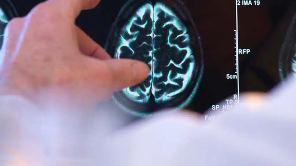 Asian Neuro Centre - Dr Navin Tiwari