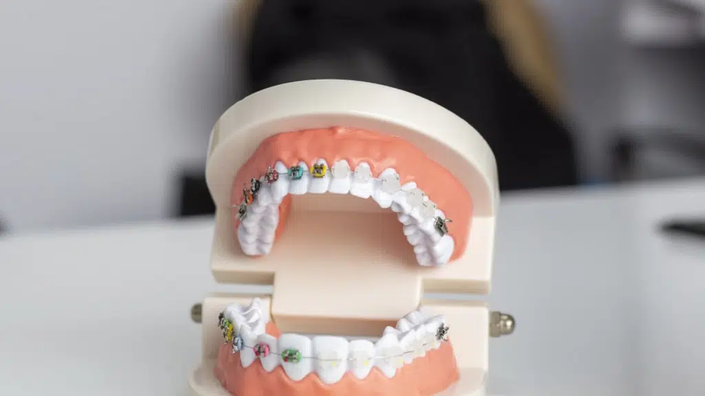 Dhee Dentists - Dental Clinic in Triplicane