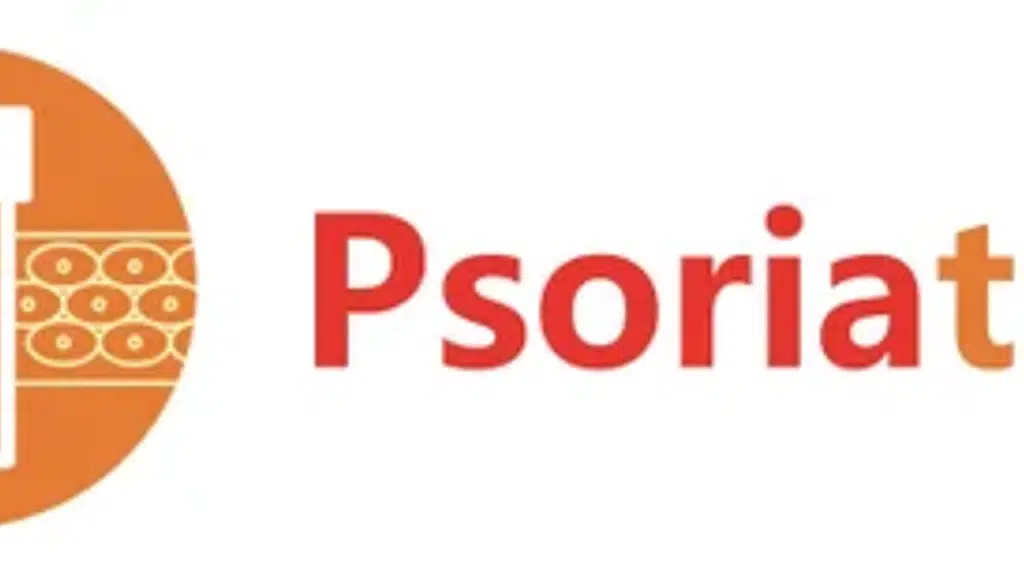 Psoriatreat