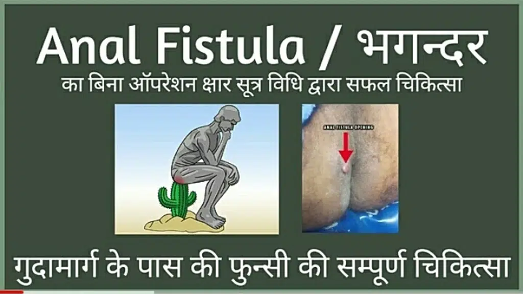 L N Ayurveda  & Ksharsutra Clinic