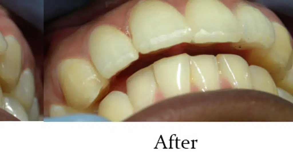 Smilestone Dental Care