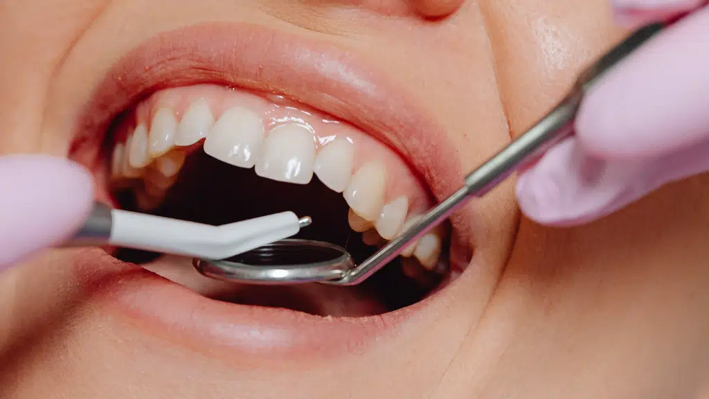 Apex Dental Hospital