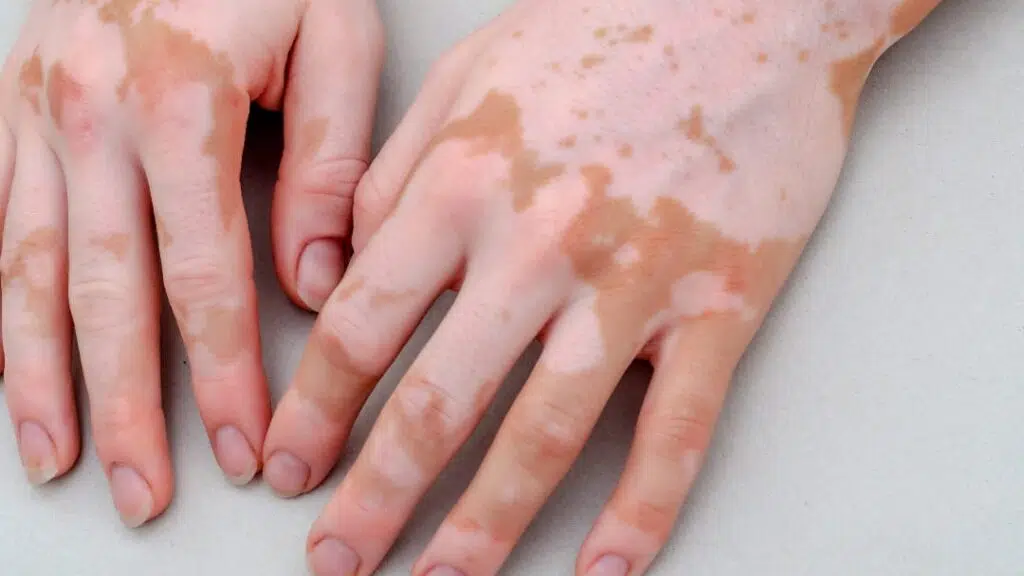 Dr. Geeta Garg's Skin Clinic