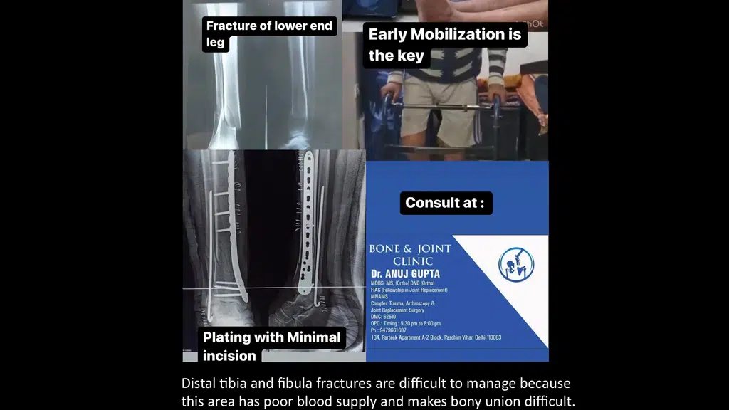 Bone & Joint Clinic - Dr. Anuj Gupta