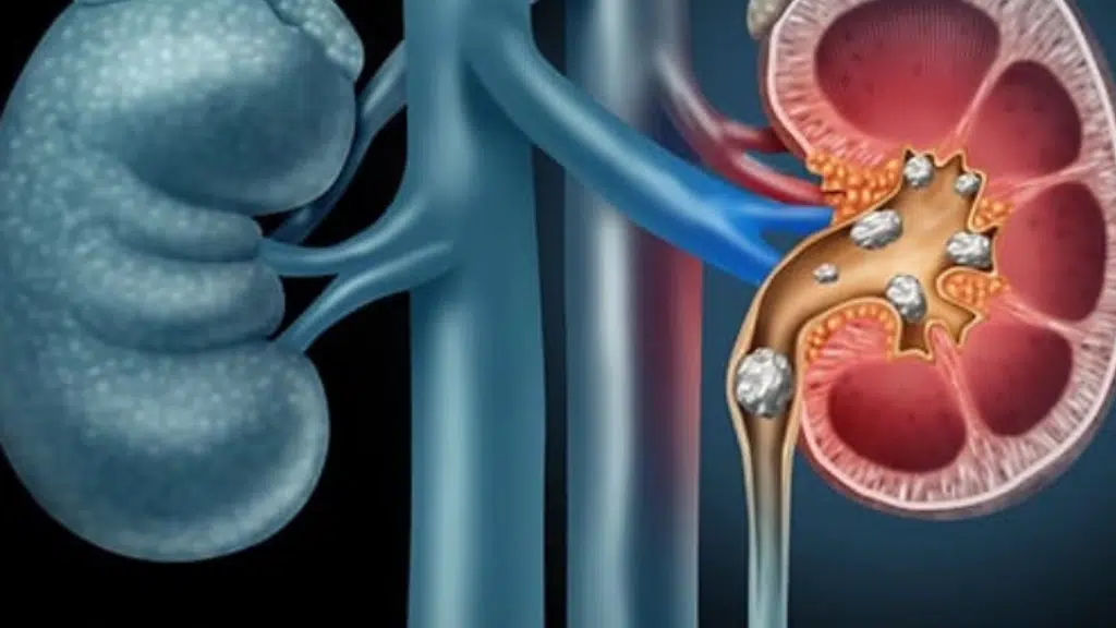 Gora Urology and Superspeciality Hospital