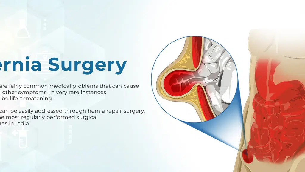 Dr. Arun Kumar Ramanathan - Best Orthopedic Surgeon in Chennai | Apollo Hospitals