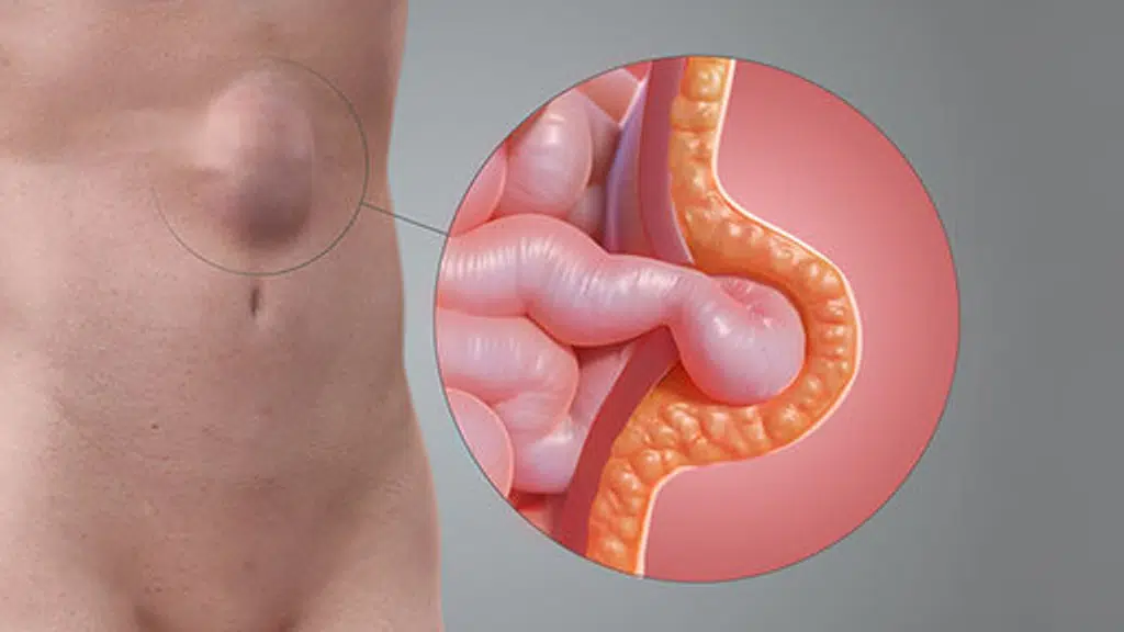 Dr. Ashutosh Soni - Minimally Invasive Surgery Centre