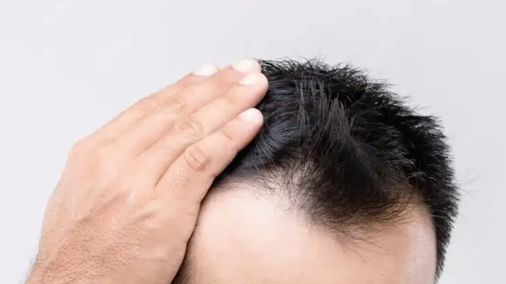 Revitalize Studios - Hair Transplant Centre in Jalandhar Punjab India