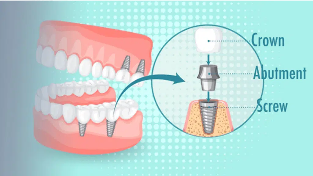 32 White Pearls Multispeciality and Advanced Dental Clinic