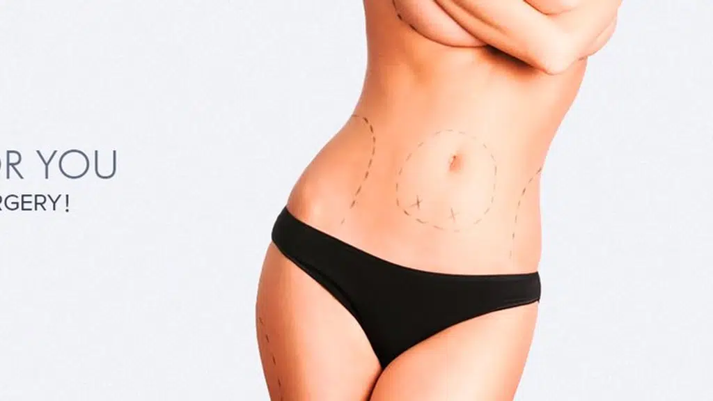 Tummy Tuck Surgery