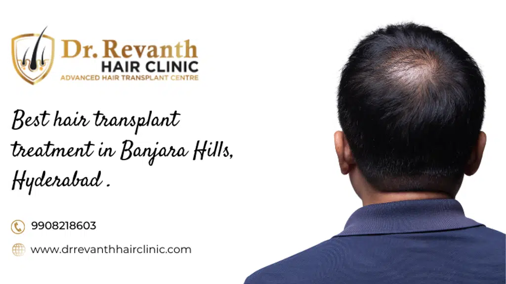 Dr. Revanth Hair Clinic