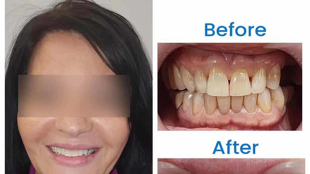 DrBhutaniDentalClinic