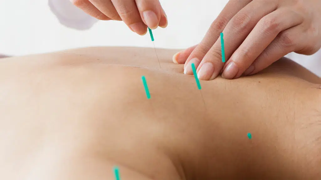 Dr. Anjali Sharma Acupuncture Clinic