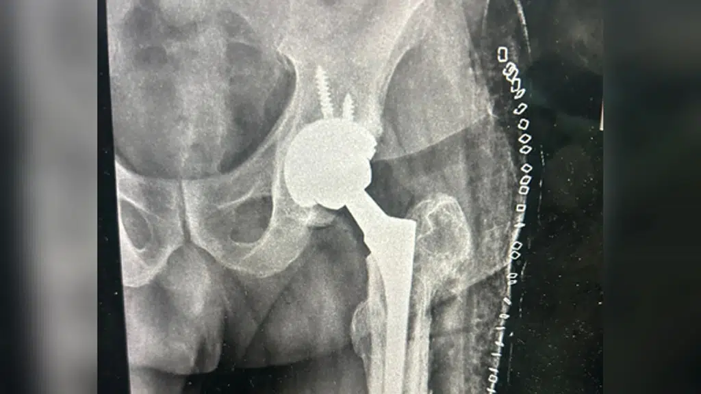 Dr Shahbaz Orthopaedic Surgeon