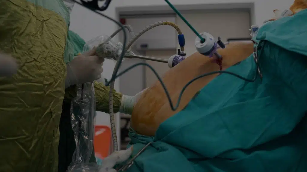 Dr. Jayadatt Pawar - Robotic & Bariatric Surgeon