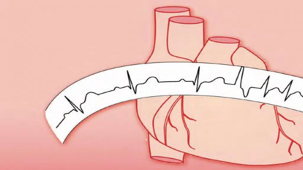 Dr Chirayu Vyas (COMPLETE HEART RHYTHM SOLUTIONS - CHRS) - Best Cardiac Electrophysiologist