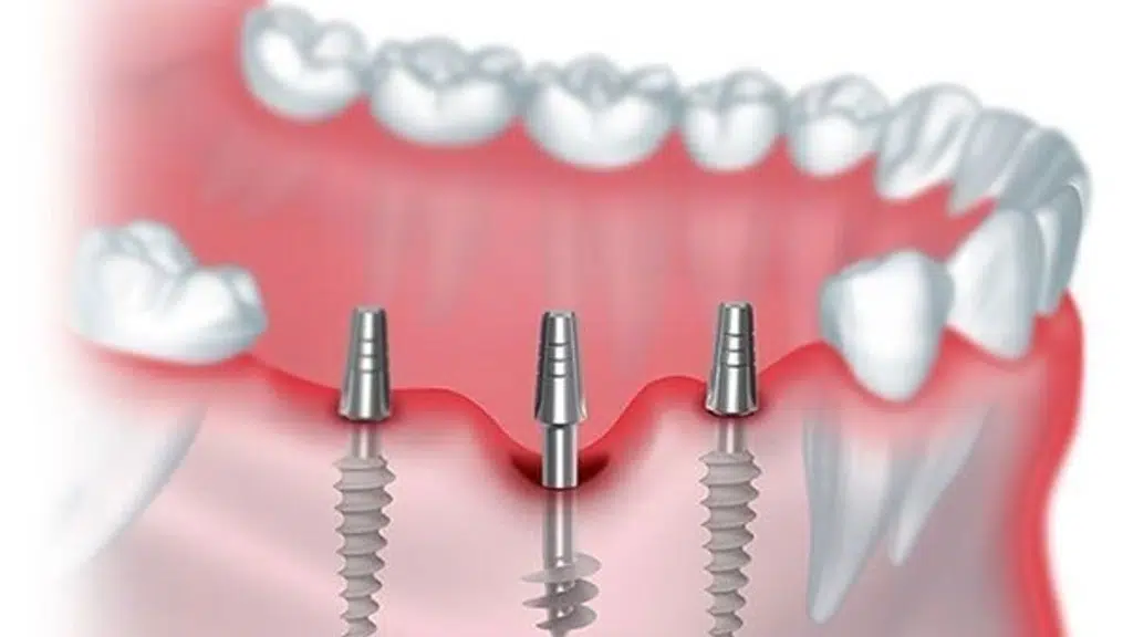 72hrs Smile Care Center - Dental clinic Pune