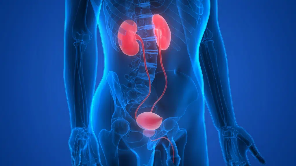 UP Stone and Urology Centre