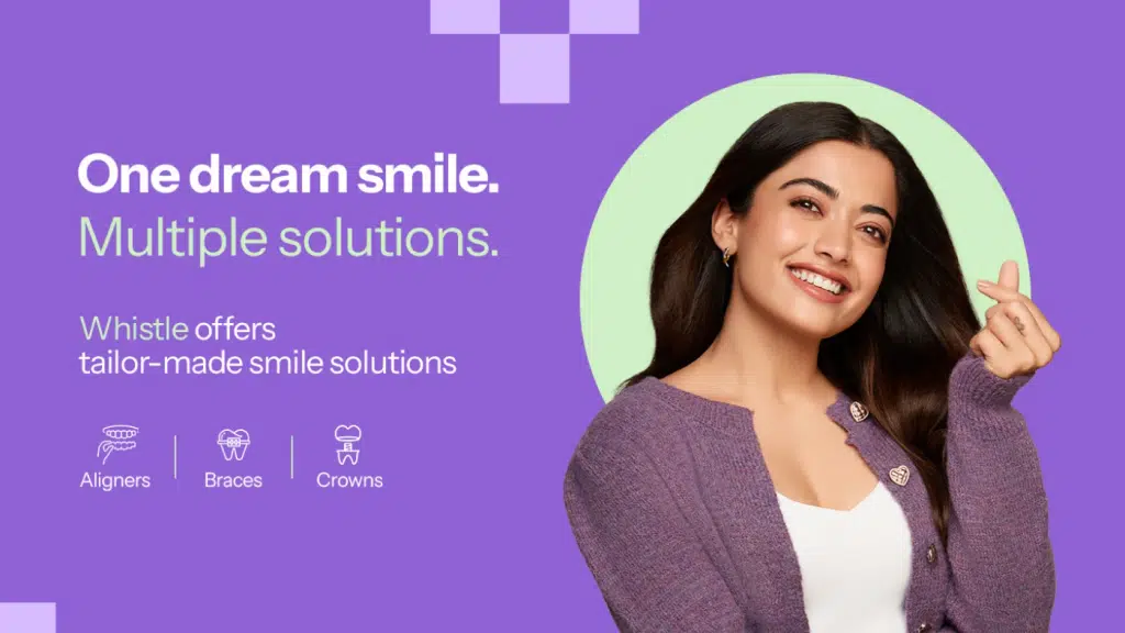 Whistle Aligners - Best Orthodontic in Hennur Bande