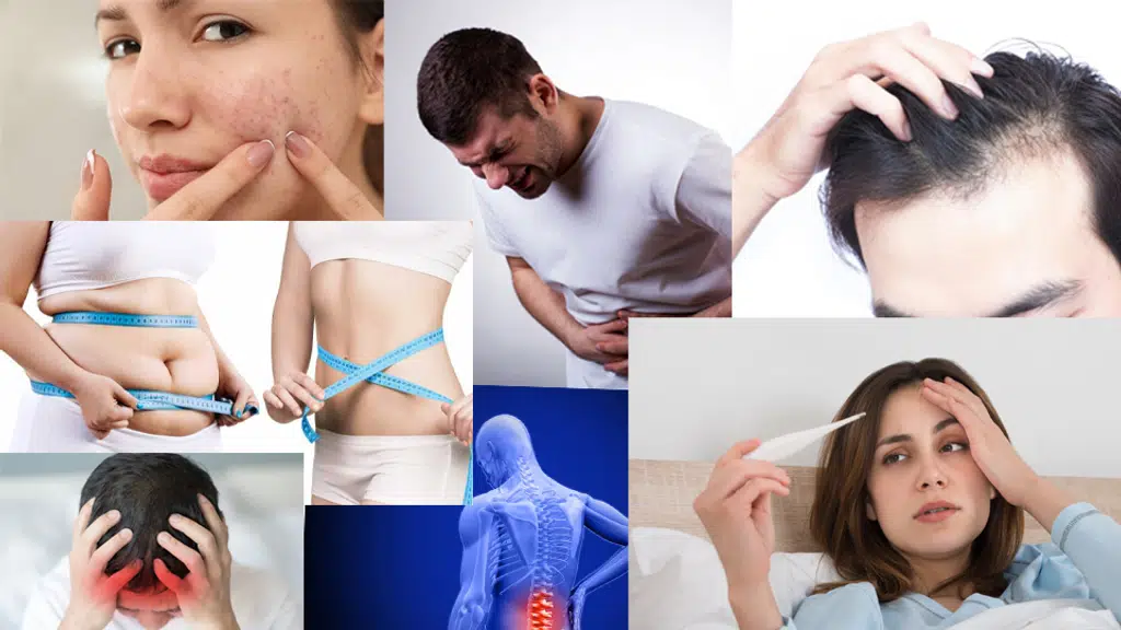 DRS Homeopathy, Dr.Rekha saroha's BHMS( Gold Medalist), PGDEMS, MD(Hair Expert)