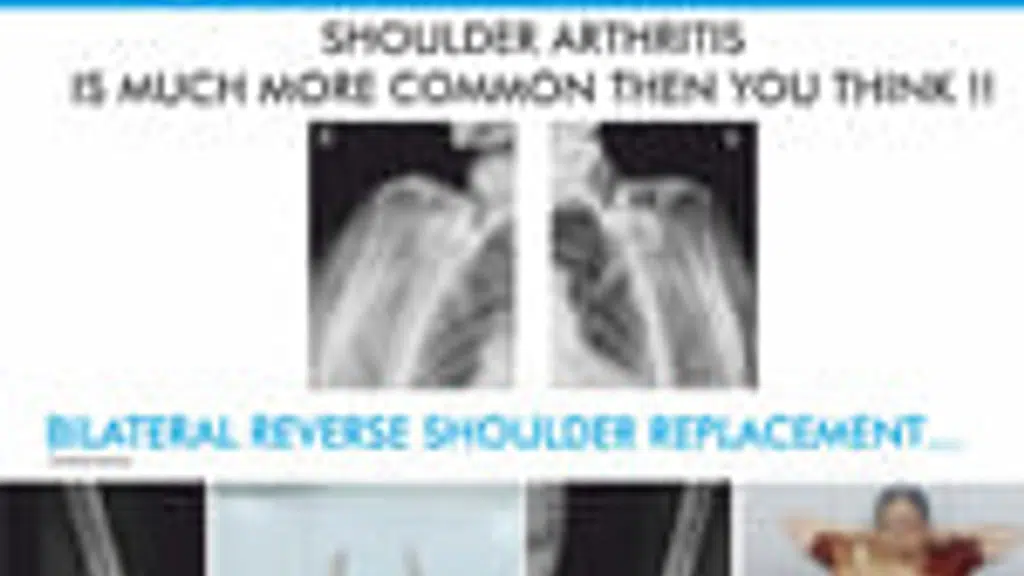Fracture and Orthopedic Hospital