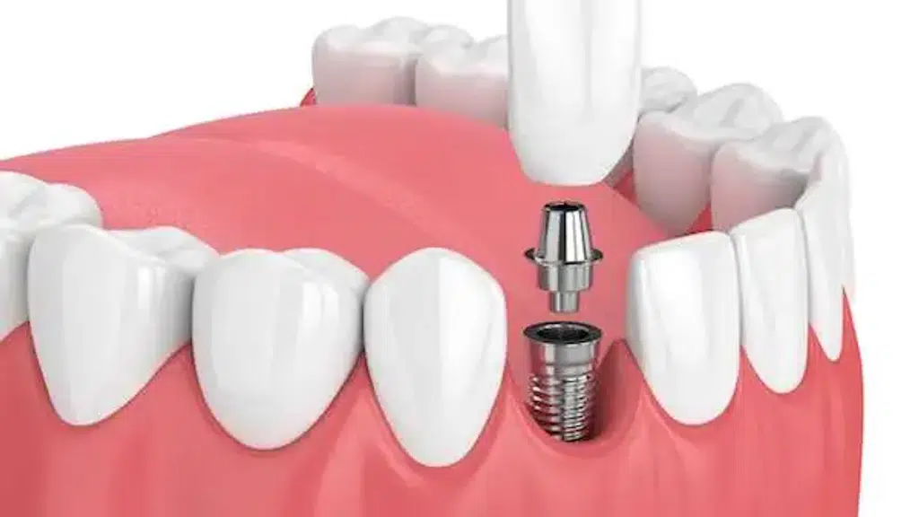 Modern Dental Hospital