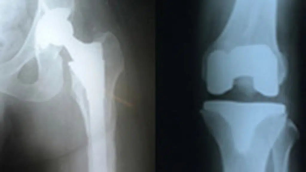 Adyar Ortho Clinic
