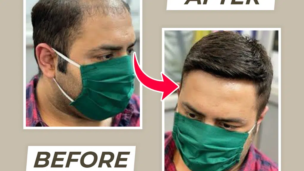 PS Hair Replacement