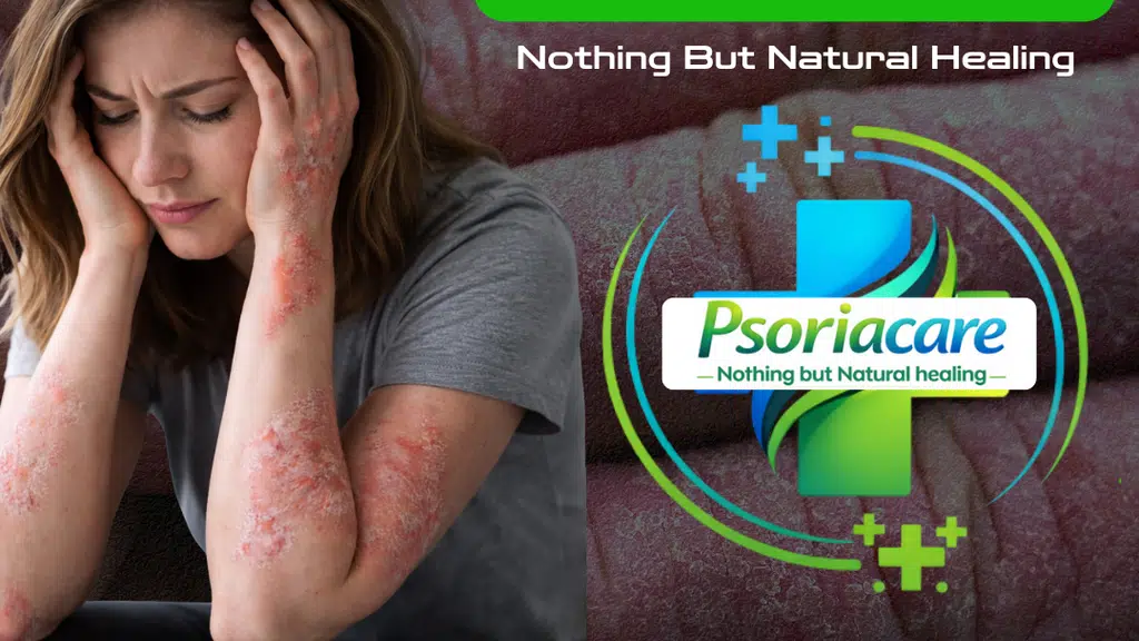 PsoriaCare