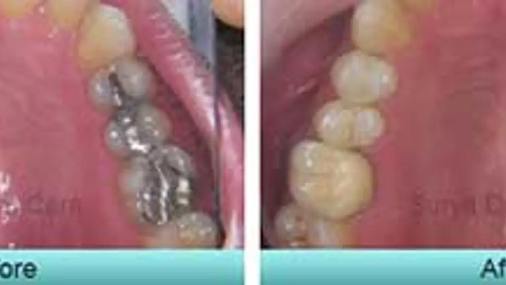Surya Dental Care
