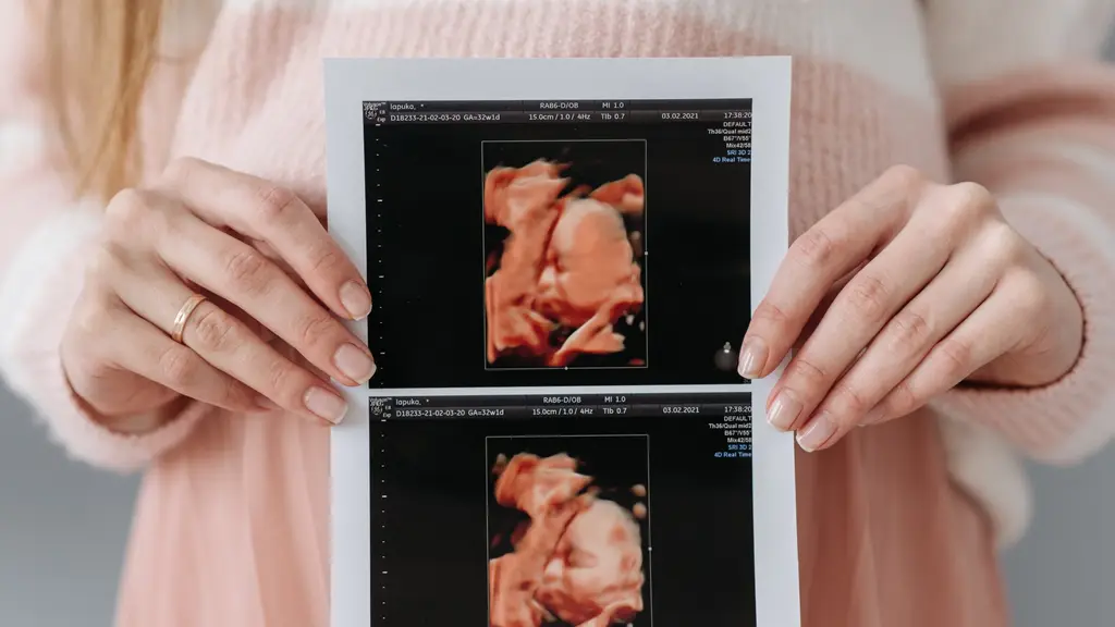 Lucknow Fetal Medicine
