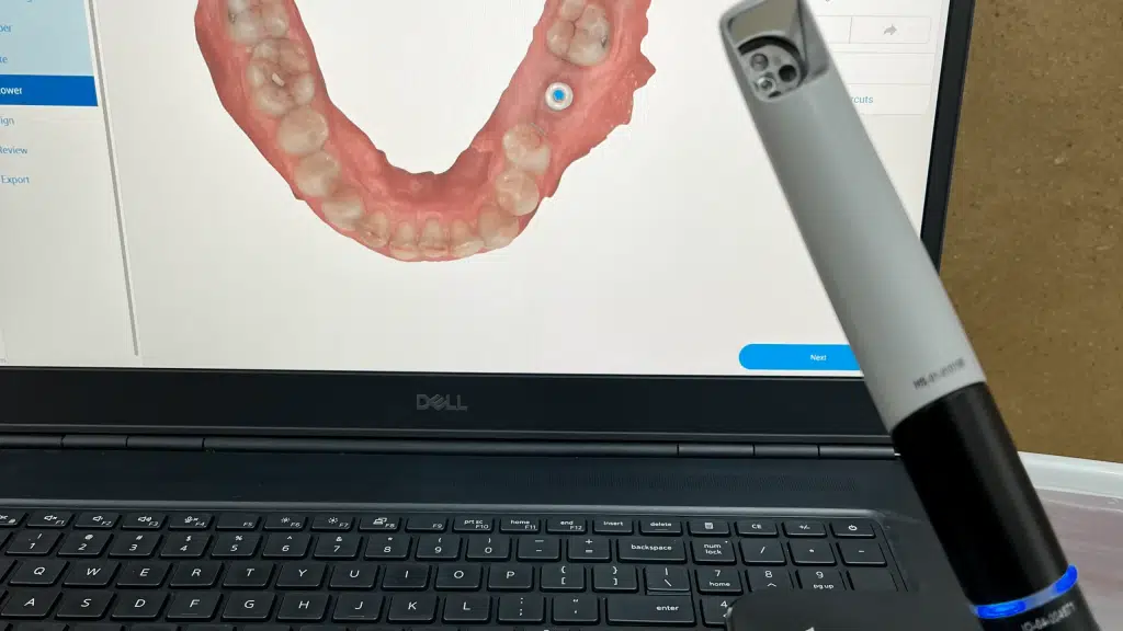 Facekraft Dental Implant Clinic