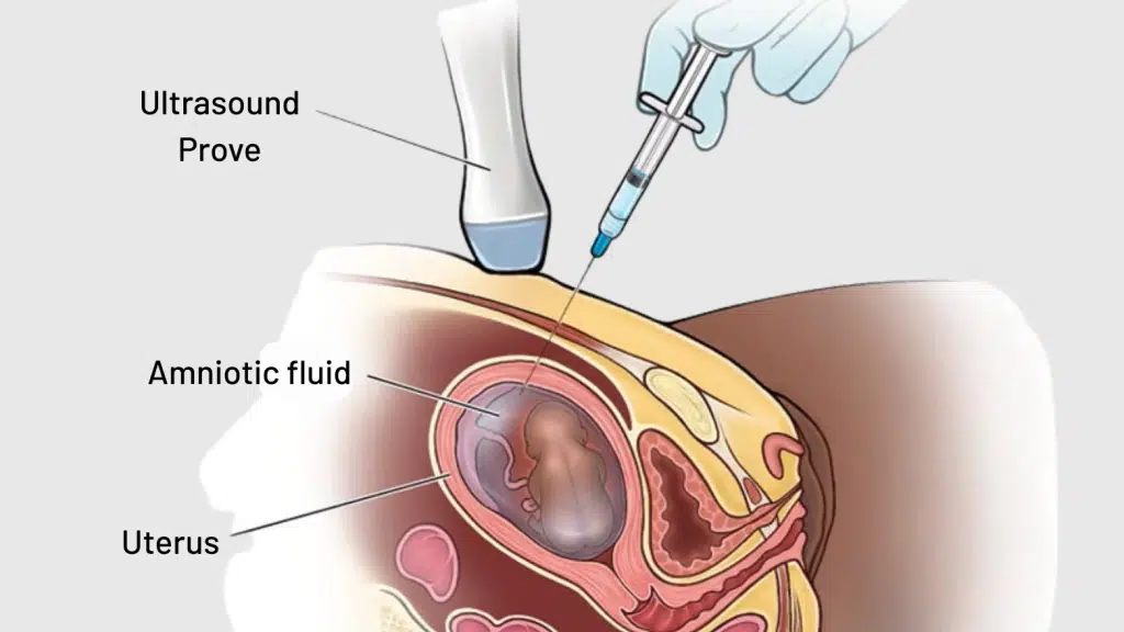 Dr Neha Gupta Fetal Medicine Consultant
