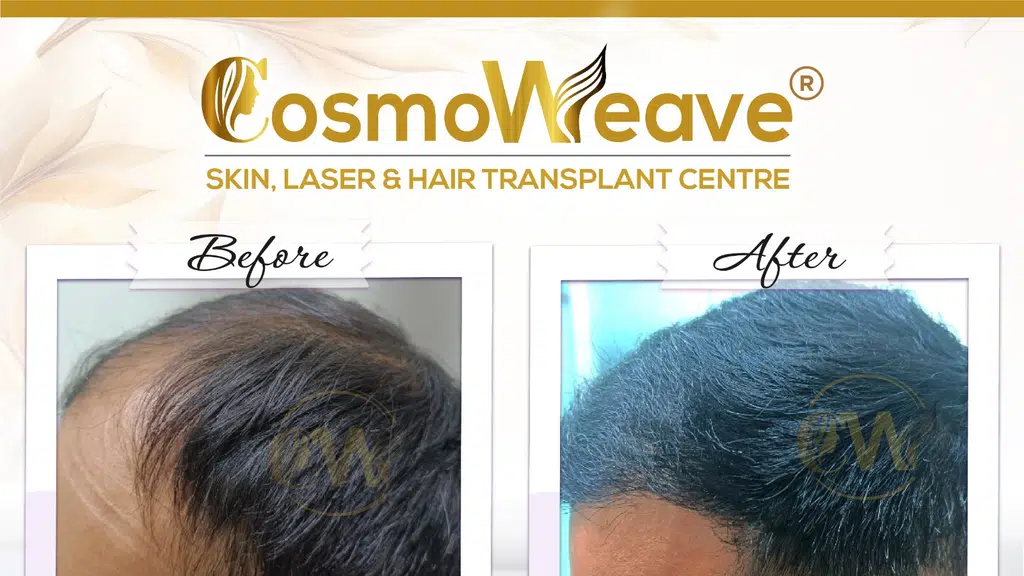 Dr. Mubashar Mashkoor Mir Skin Specialist