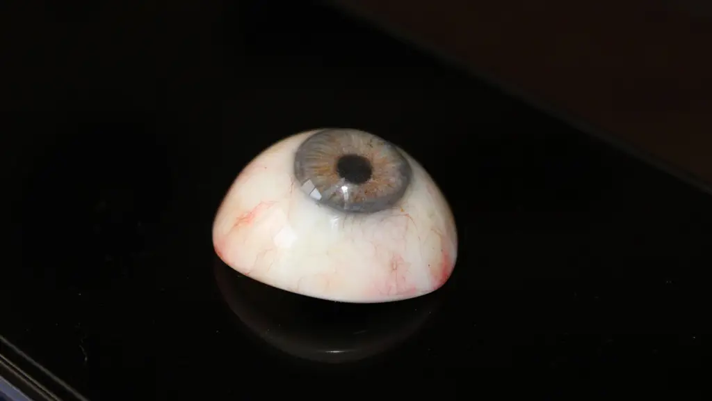 Mehra's Ocular Prosthetics