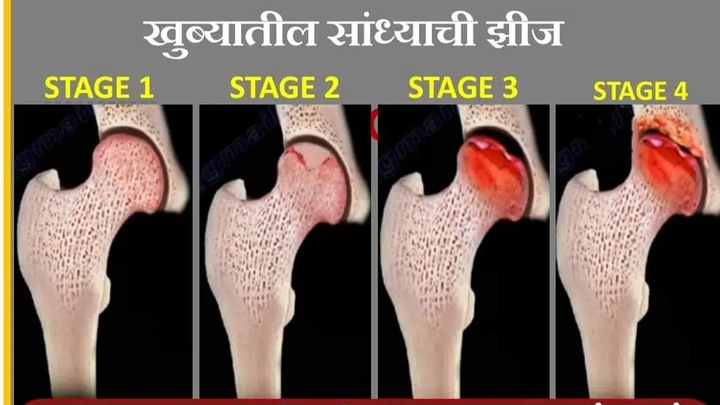 Vaidya Pawar Hip & Spine Clinic Ratnagiri.