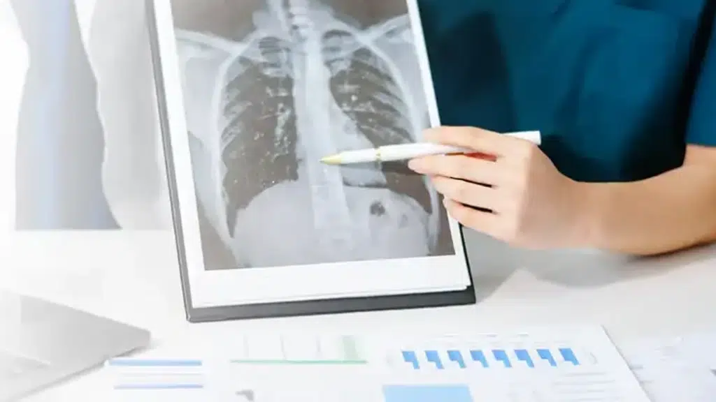 Chennai Institute of Pulmonology