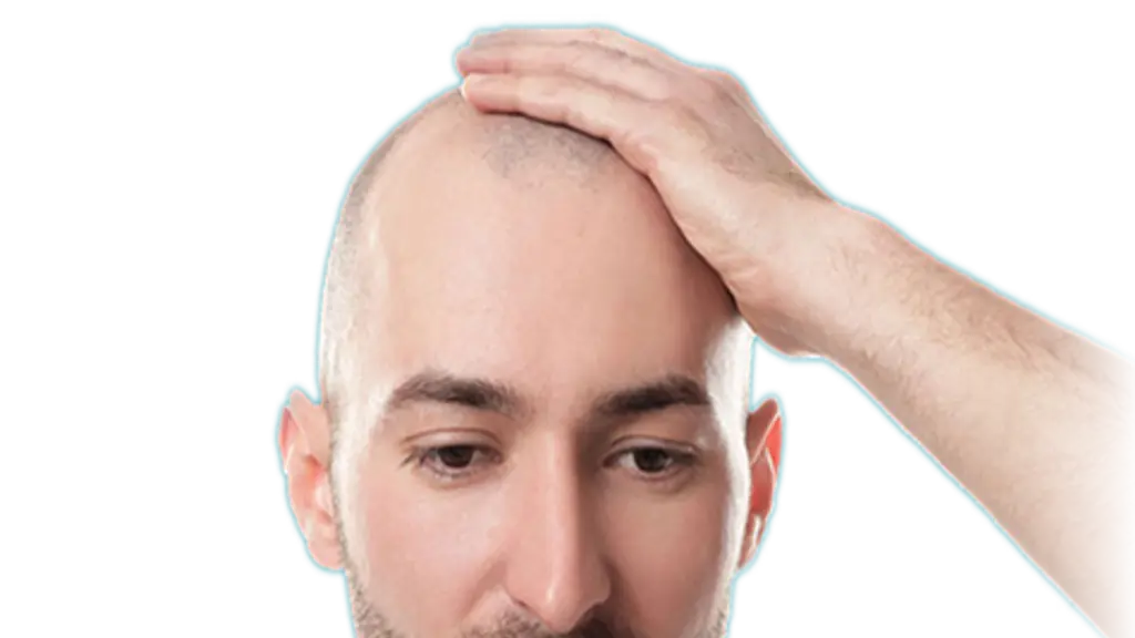 Uttam Hair Wig Solution